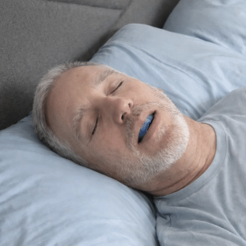 Feliora Anti-Snoring Mouthpiece (Buy 1 Get 1 Free)